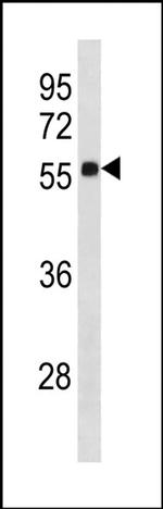 ZNF502 Antibody in Western Blot (WB)
