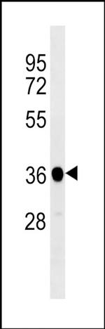 PP1 beta Antibody in Western Blot (WB)