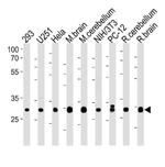 PITPN Antibody in Western Blot (WB)
