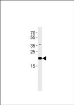 C2orf74 Antibody in Western Blot (WB)