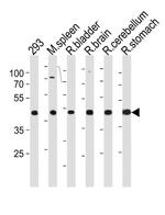 Ccdc89 Antibody in Western Blot (WB)