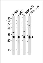 ESD Antibody in Western Blot (WB)