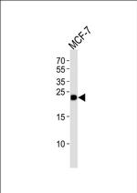 GSTM4 Antibody in Western Blot (WB)