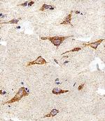 IDH3B Antibody in Immunohistochemistry (Paraffin) (IHC (P))