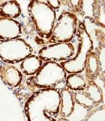 MPP7 Antibody in Immunohistochemistry (Paraffin) (IHC (P))