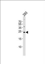 GADD45GIP1 Antibody in Western Blot (WB)