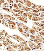 ZNF175 Antibody in Immunohistochemistry (Paraffin) (IHC (P))