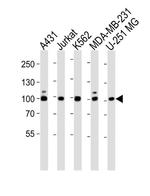 ZNF175 Antibody in Western Blot (WB)