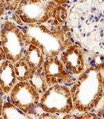 FBXL17 Isoform 2 Antibody in Immunohistochemistry (Paraffin) (IHC (P))