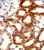 FBXL17 Isoform 2 Antibody in Immunohistochemistry (Paraffin) (IHC (P))