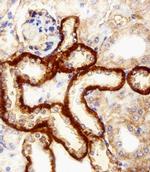 FBXL17 Isoform 2 Antibody in Immunohistochemistry (Paraffin) (IHC (P))