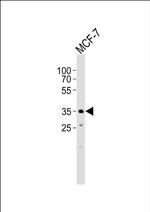 FBXL17 Isoform 2 Antibody in Western Blot (WB)