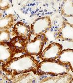 NDUFC2 Antibody in Immunohistochemistry (Paraffin) (IHC (P))