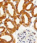 NDUFC2 Antibody in Immunohistochemistry (Paraffin) (IHC (P))