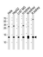 NDUFC2 Antibody in Western Blot (WB)