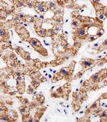 AGAP4 Antibody in Immunohistochemistry (Paraffin) (IHC (P))