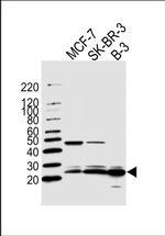 C13orf30 Antibody in Western Blot (WB)