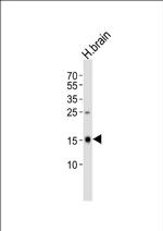 FXYD6 Antibody in Western Blot (WB)