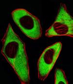 RPL6 Antibody in Immunocytochemistry (ICC/IF)