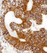 RPL6 Antibody in Immunohistochemistry (Paraffin) (IHC (P))