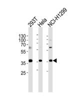 RPL6 Antibody in Western Blot (WB)