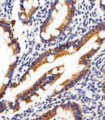 SHB Antibody in Immunohistochemistry (Paraffin) (IHC (P))