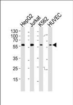 SHB Antibody in Western Blot (WB)