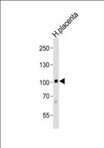 LEPRE1 Antibody in Western Blot (WB)