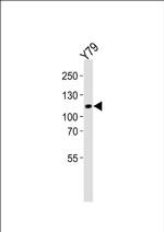 ANKRD24 Antibody in Western Blot (WB)