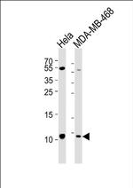 SNRPG Antibody in Western Blot (WB)