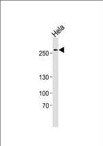 AHCTF1 Antibody in Western Blot (WB)