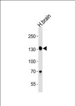 ZNF423 Antibody in Western Blot (WB)