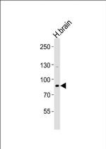 ANKRD20A8P Antibody in Western Blot (WB)
