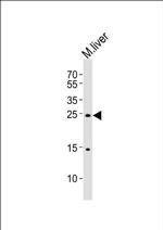 PDCD6 Antibody in Western Blot (WB)