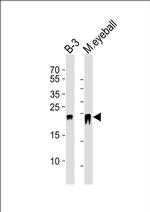 CRYBB2 Antibody in Western Blot (WB)