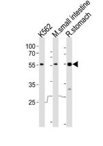 FRK Antibody in Western Blot (WB)