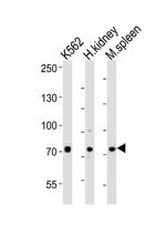 SDAD1 Antibody in Western Blot (WB)