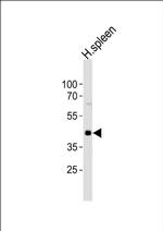 CHST12 Antibody in Western Blot (WB)