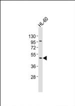 CHST12 Antibody in Western Blot (WB)