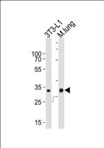 CHMP3 Antibody in Western Blot (WB)