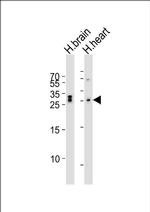 CHMP3 Antibody in Western Blot (WB)