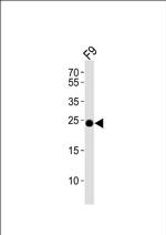 ERAS Antibody in Western Blot (WB)