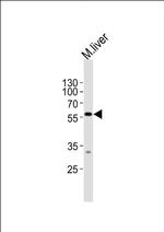 DPYS Antibody in Western Blot (WB)