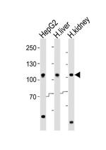 MTTP Antibody in Western Blot (WB)