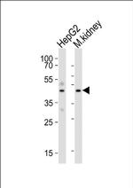DNase I Antibody in Western Blot (WB)