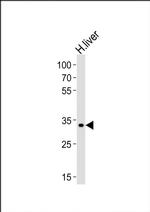LRTOMT Antibody in Western Blot (WB)