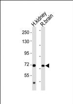 AACS Antibody in Western Blot (WB)