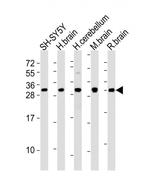 FGF14 Antibody in Western Blot (WB)