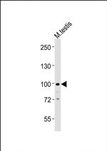 PCQAP Antibody in Western Blot (WB)