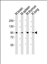 PCQAP Antibody in Western Blot (WB)